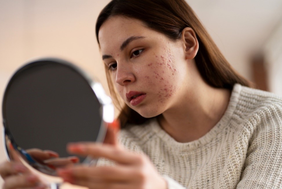 Hati-Hati! 4 Produk Skincare Ini Ternyata Bisa Merusak Skin Barrier lho! Tidak Direkomendasikan!